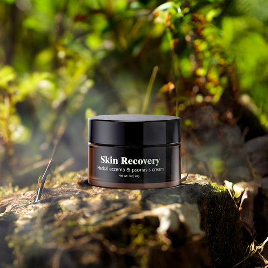 Skin Recovery | Herbal eczema & psoriasis cream